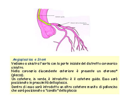 cuore55